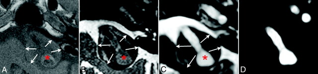 Fig 2.