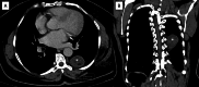 Fig. 10