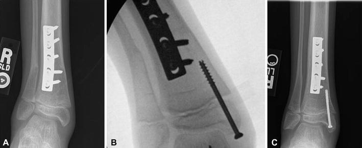 Fig. 11