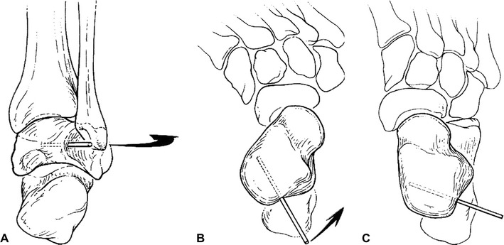 Fig. 2