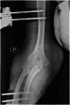 Fig. 3A