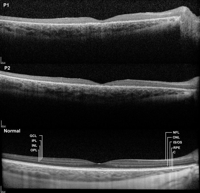 Fig. 2