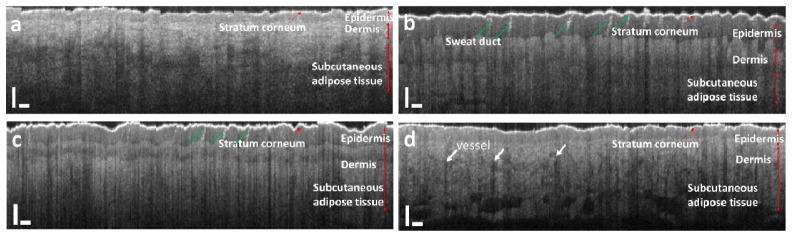 Fig. 11