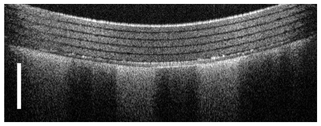 Fig. 12