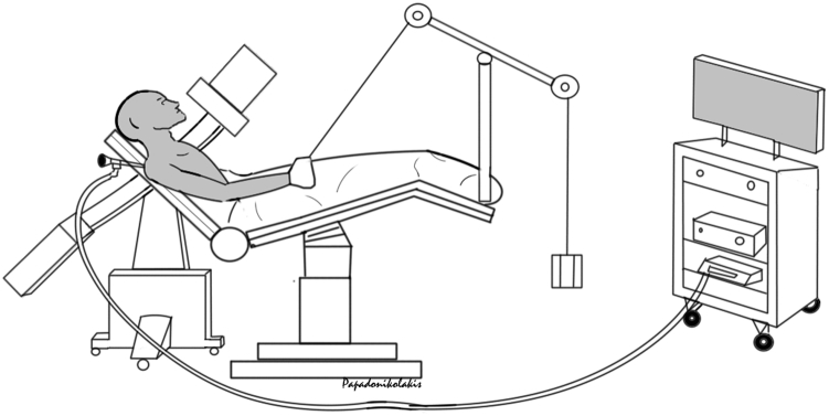 Fig 1