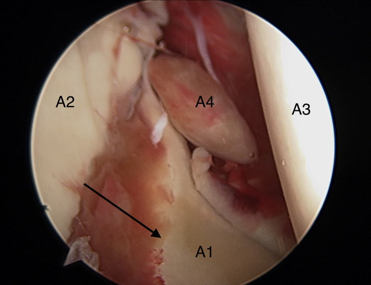 Fig 2