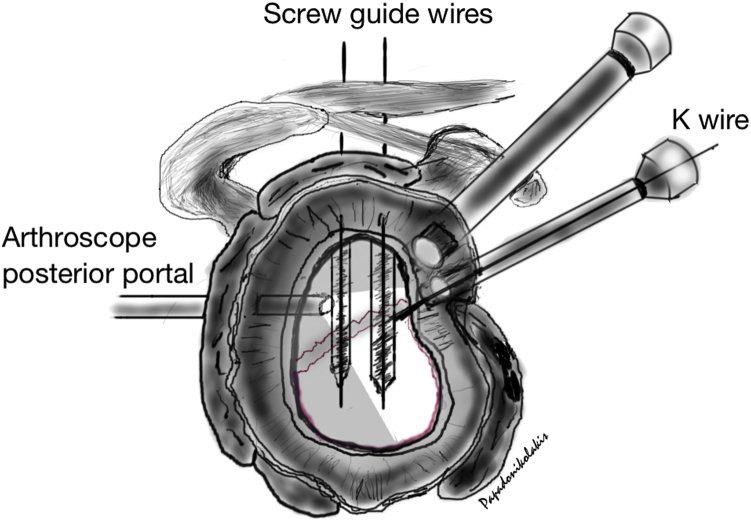 Fig 7