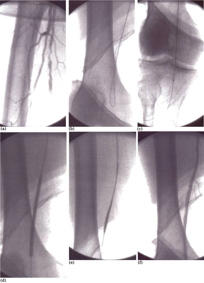 Figure 4 (a-f).