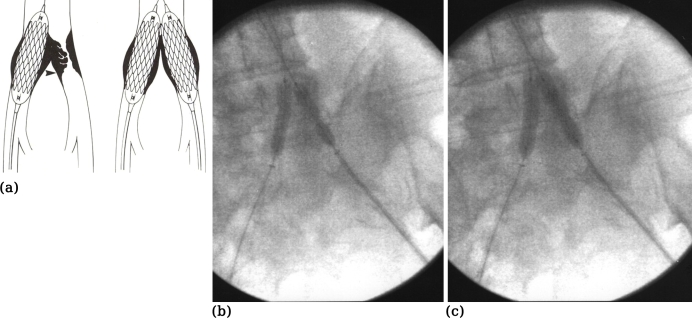 Figure 3 (a-c).