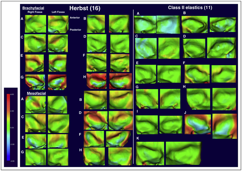 Fig 3.