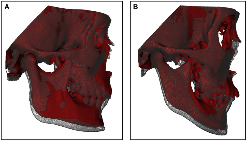 Fig 2.