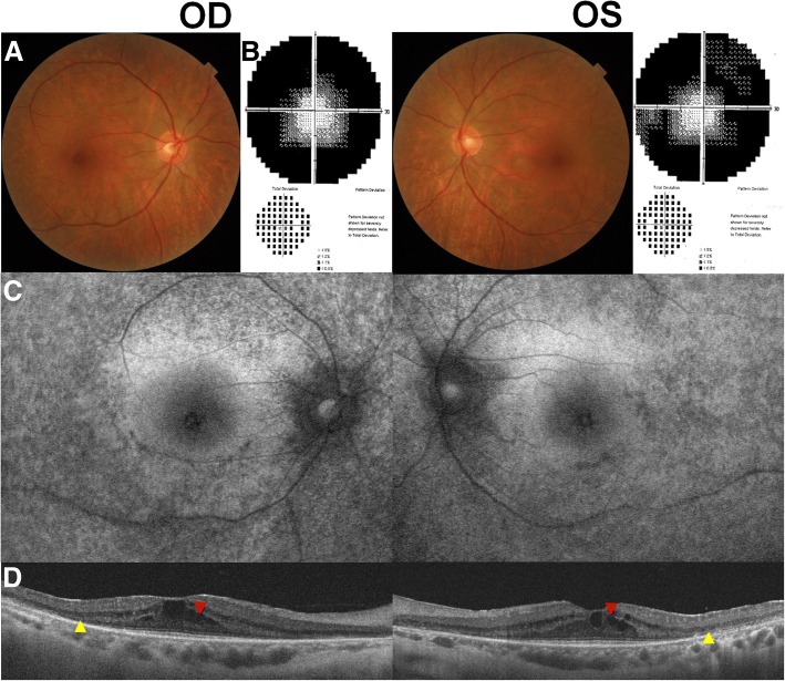 Fig. 1