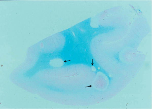 Fig. 12.7