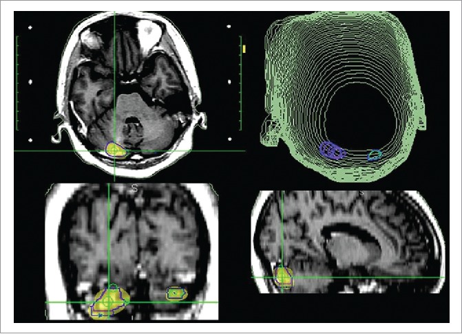 Figure 2.