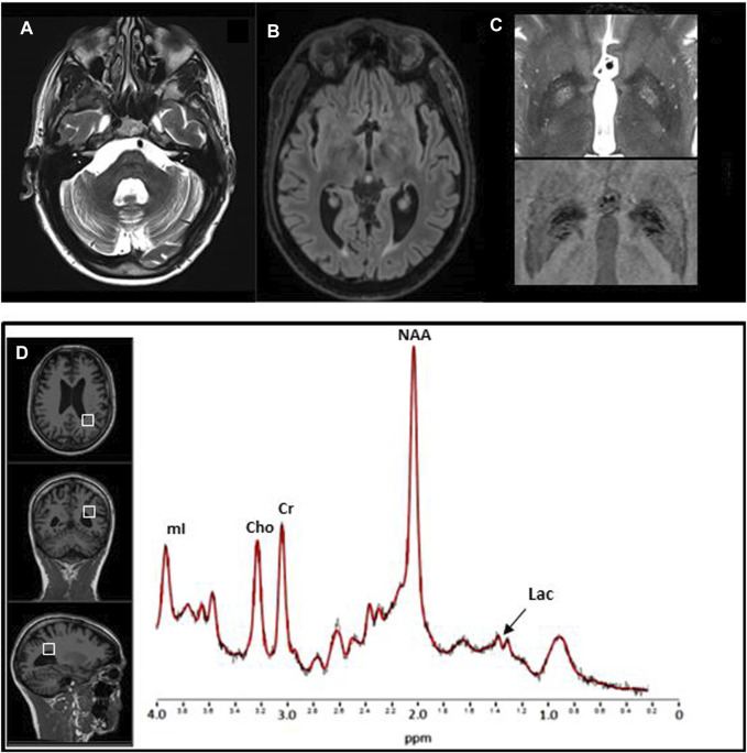 FIGURE 4