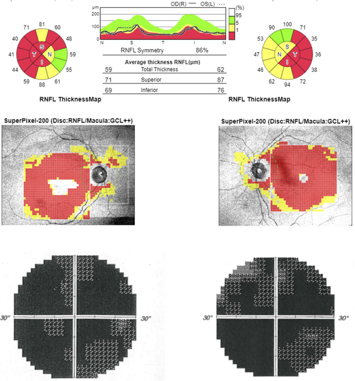 FIGURE 3