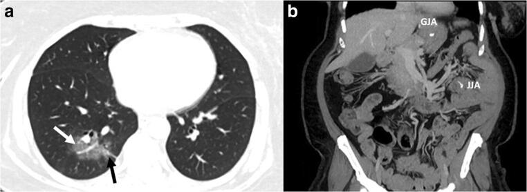 Fig. 1