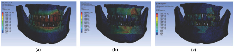 Figure 14