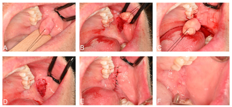 Figure 6