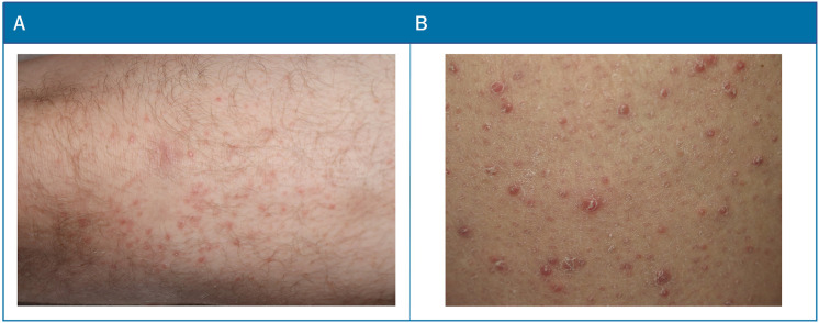 Fig. 9