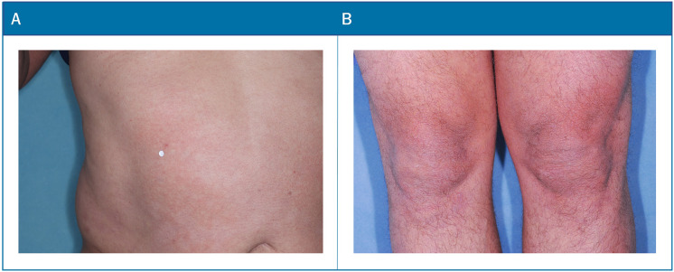 Fig. 10