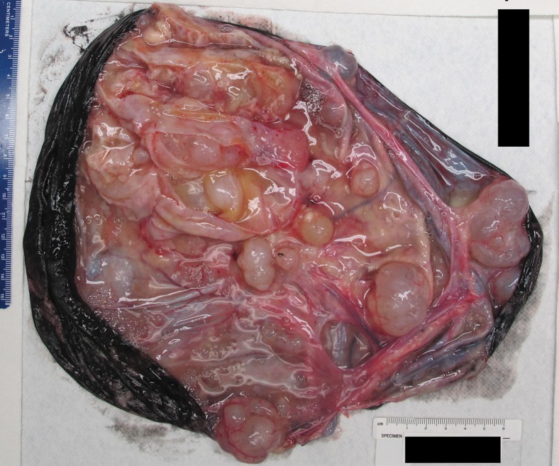 Figure 6d.