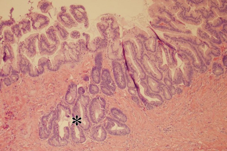 Figure 5f.