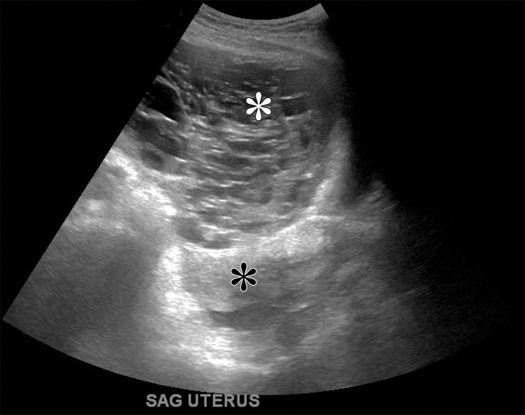 Figure 10a.