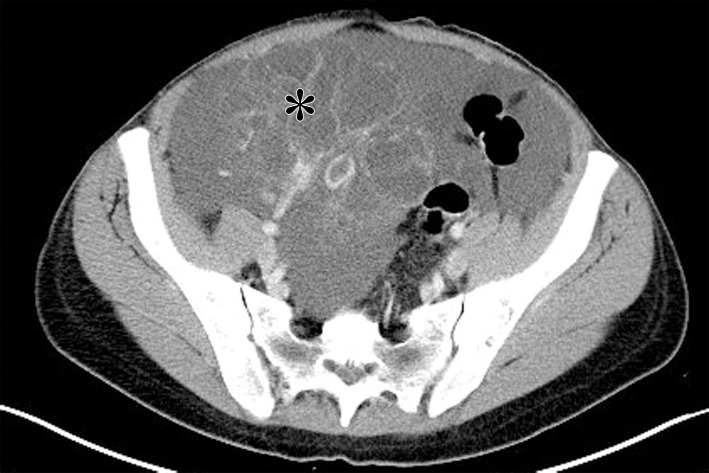 Figure 9a.