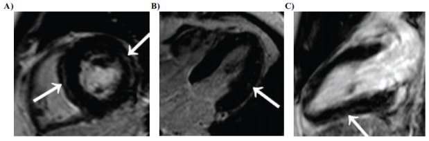 Fig. (1)