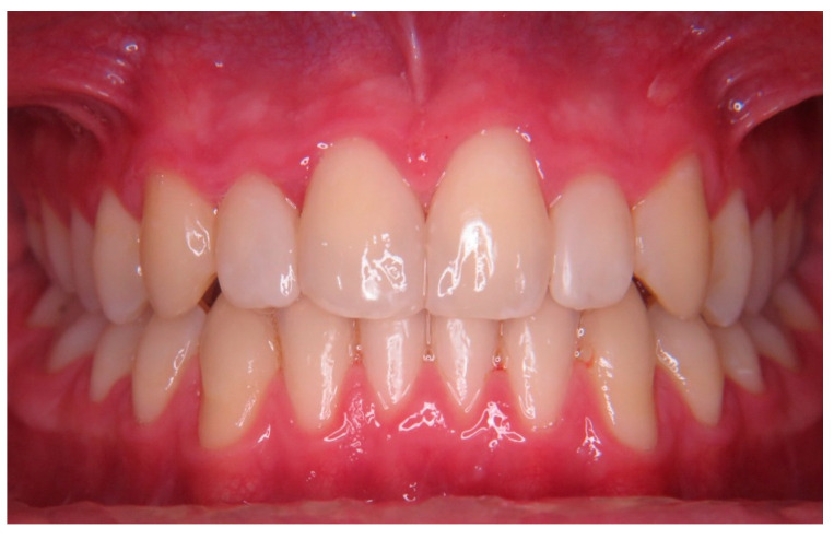 Figure 10