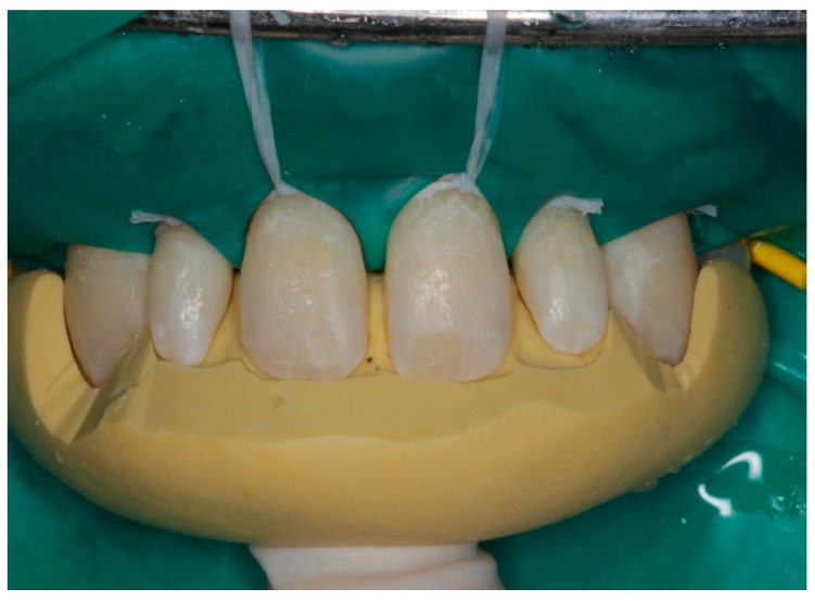 Figure 9