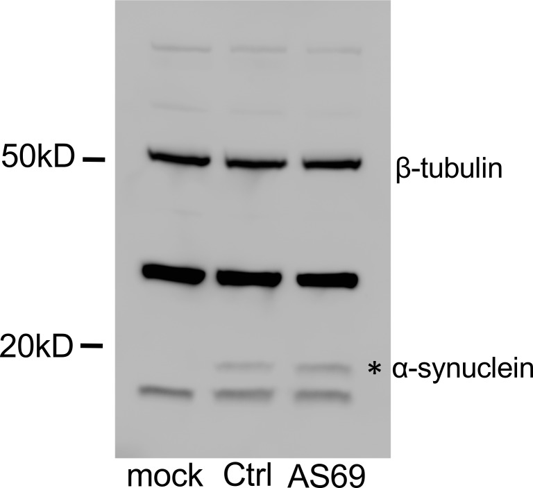 Figure 2—figure supplement 1.