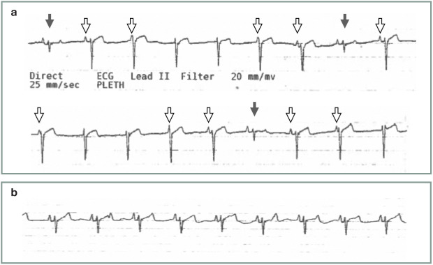 Figure 25