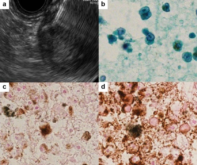 Fig. 4