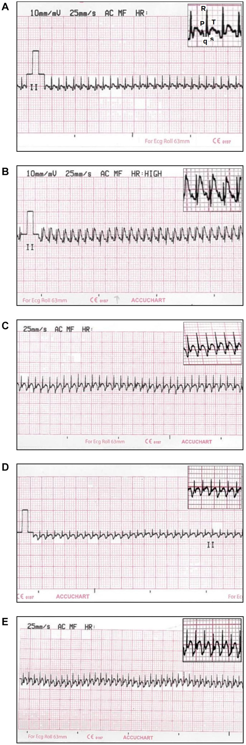 FIGURE 3