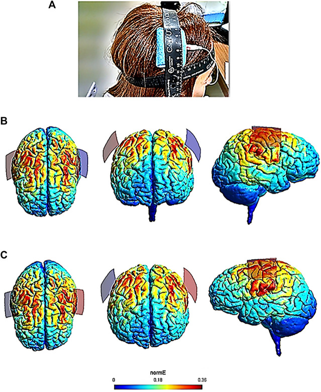 FIGURE 1