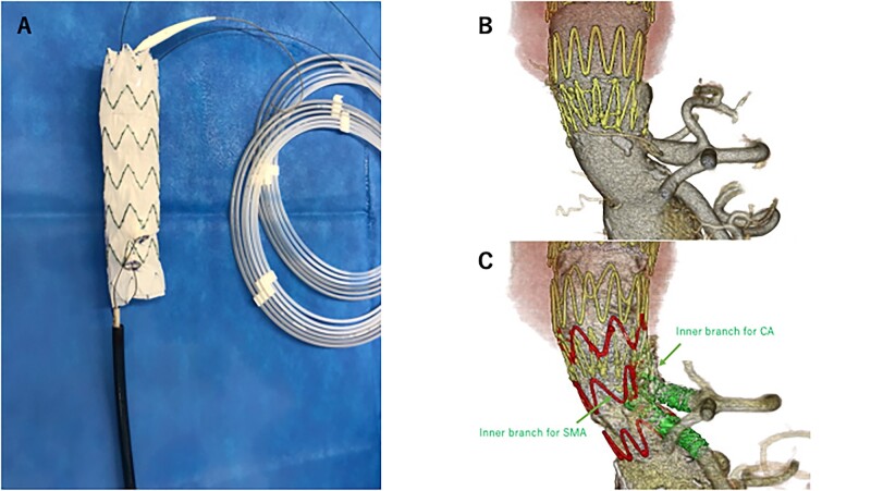 Figure 1: