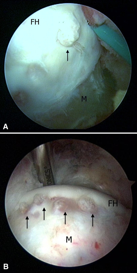 Fig. 4A–B