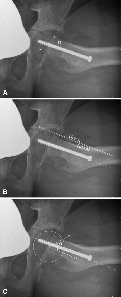 Fig. 7A–C