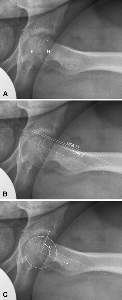 Fig. 1A–C