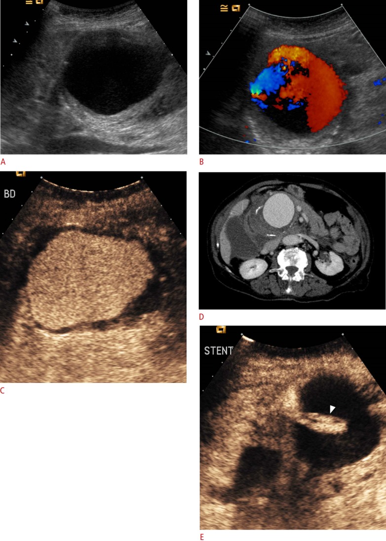 Fig. 13.