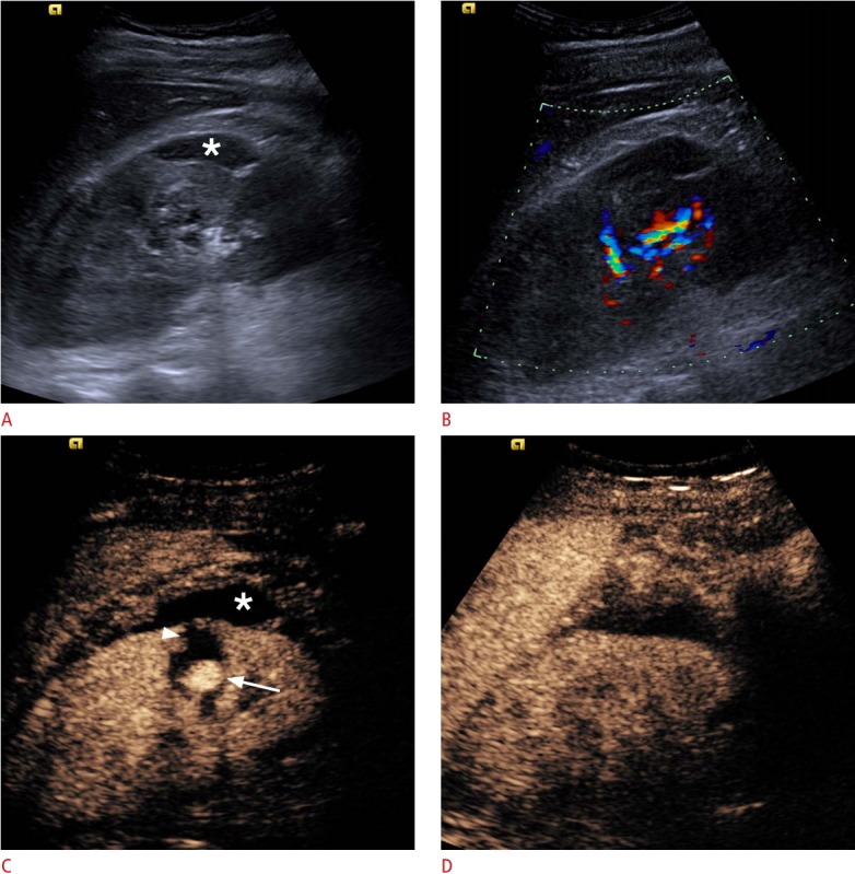 Fig. 14.