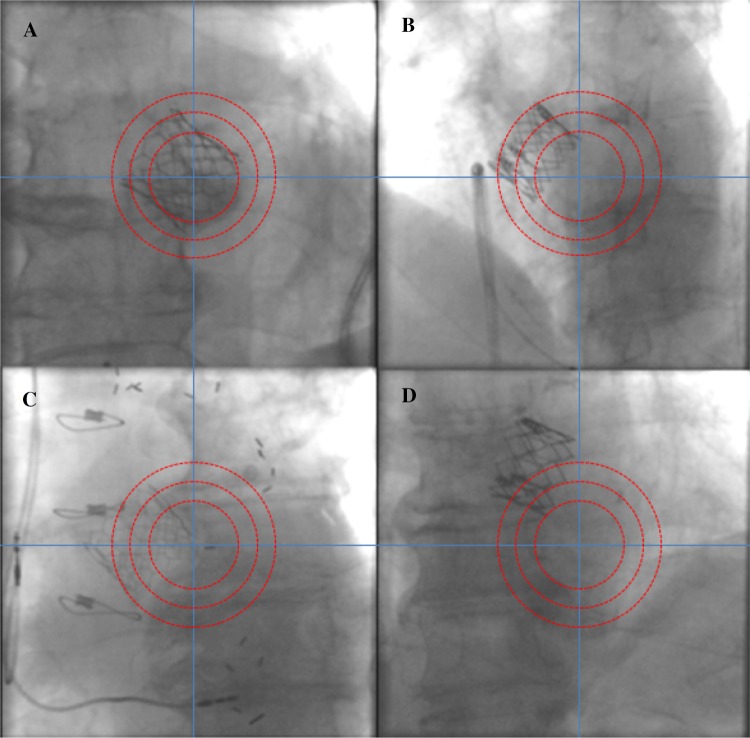 Fig. 4