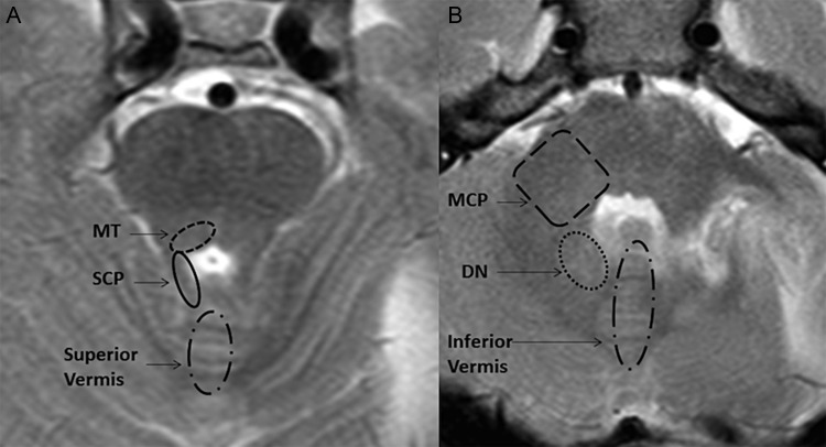 Fig. 1.