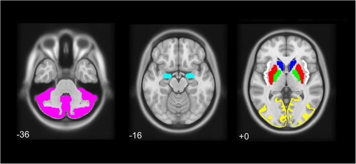 Fig. 1