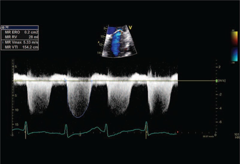 FIGURE 3