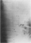 139