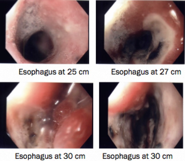 Figure 2: