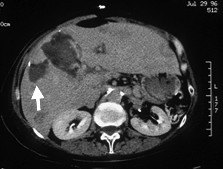 Figure 9b: